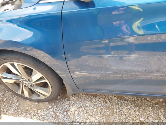 Hyundai Elantra Limited 2014 KMHDH4AE2EU153955 Image 12