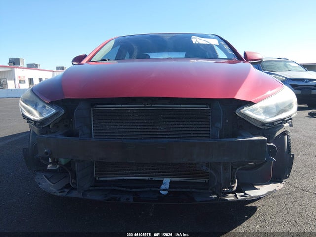 KMHD74LF0HU394538 Hyundai ELANTRA SE