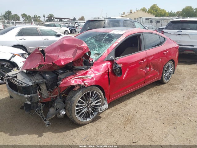 Hyundai Elantra Value Edition 2017 5NPD84LF5HH204907 Image 2