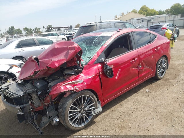Hyundai Elantra Value Edition 2017 5NPD84LF5HH204907 Image 6