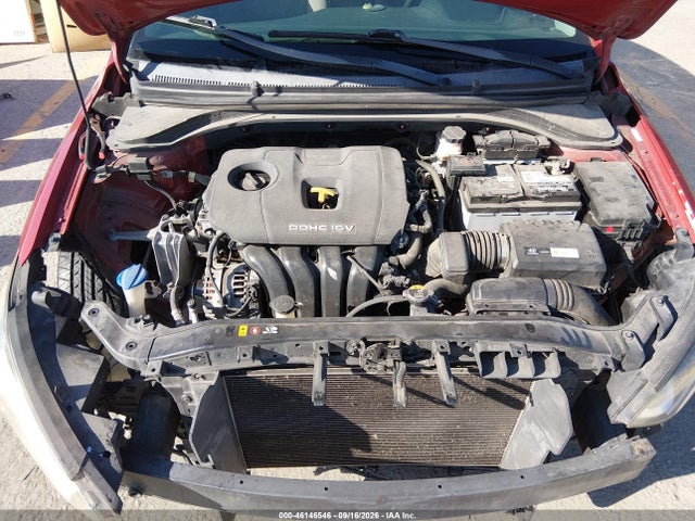 KMHD74LF5HU084515 Hyundai ELANTRA SE