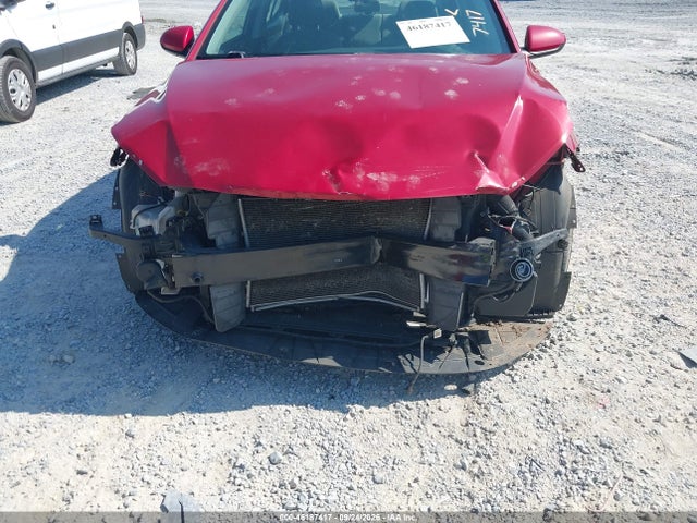 Продажа на аукционе авто 2017 Hyundai Elantra Se, vin: KMHD74LF8HU371623, номер лота: 46187417
