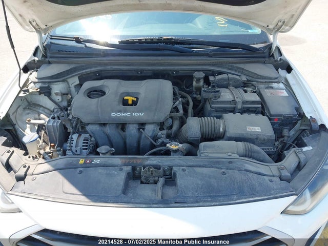 KMHD84LF6HU188041 Hyundai 2017
