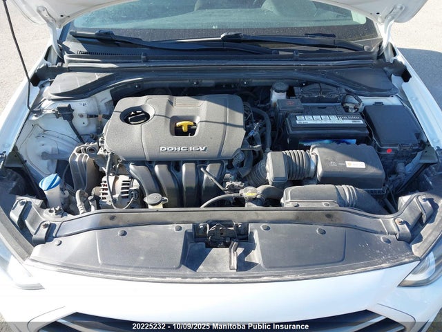 KMHD84LF5JU551158 Hyundai mpi nu