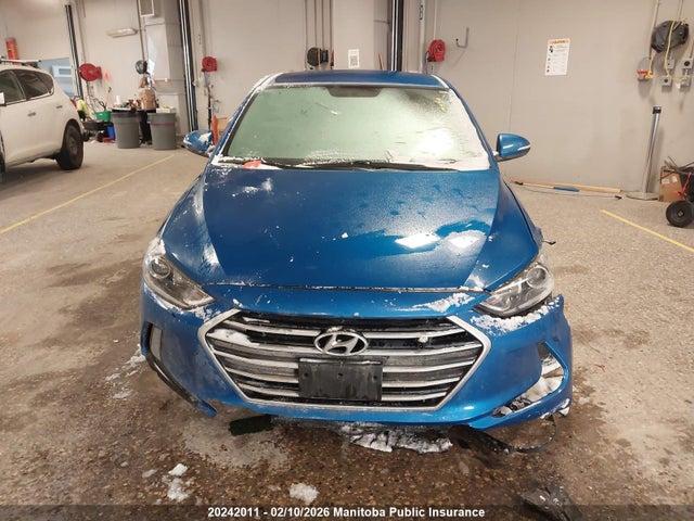 KMHD84LF4JU643054 Hyundai ELANTRA GL