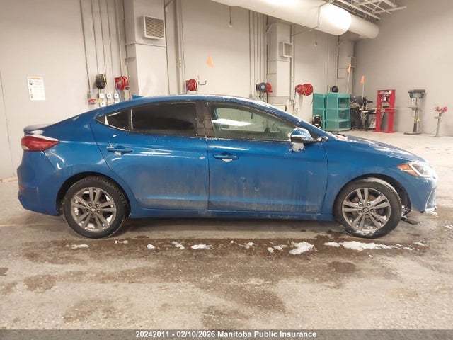 KMHD84LF4JU643054 Hyundai ELANTRA GL