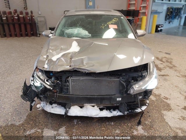 KMHLM4AG1PU511722 Hyundai Elantra Preferred