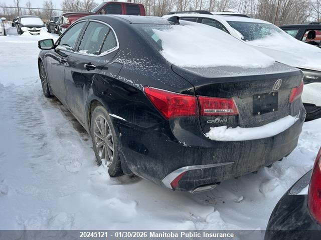 Acura TLX TECH 2018 19UUB1F50JA800010 Image 3