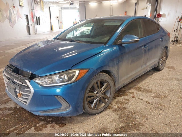 KMHD84LF6HU303107 Hyundai ELANTRA GL