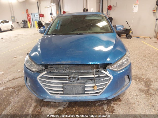 KMHD84LF6HU303107 Hyundai ELANTRA GL