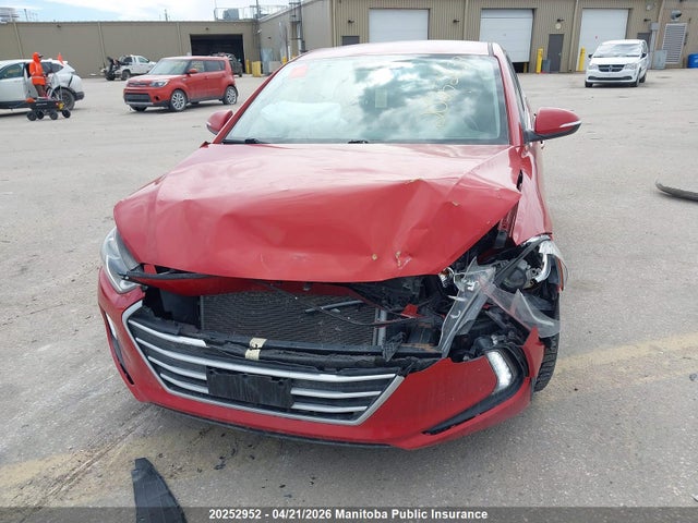 KMHD84LF7JU678560 Hyundai ELANTRA GL