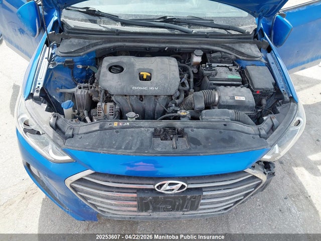 KMHD84LF5JU477627 Hyundai Elantra Gls