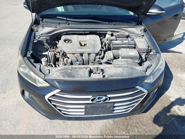 KMHD84LF3JU666812 Hyundai ELANTRA GL