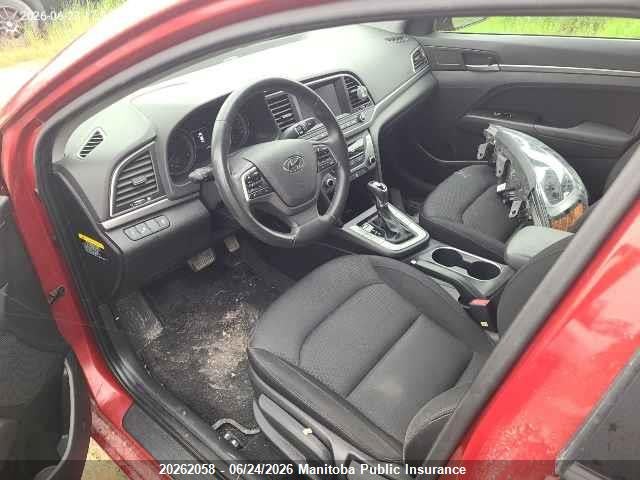 Продаж на аукціоні авто 2017 Hyundai Elantra Gl, vin: KMHD84LFXHU148951, номер лоту: 20262058