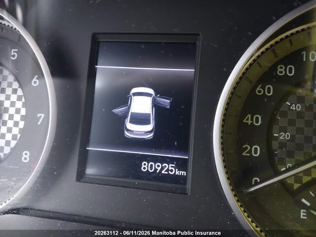KMHD84LF5LU973224 Hyundai Elantra Preferred