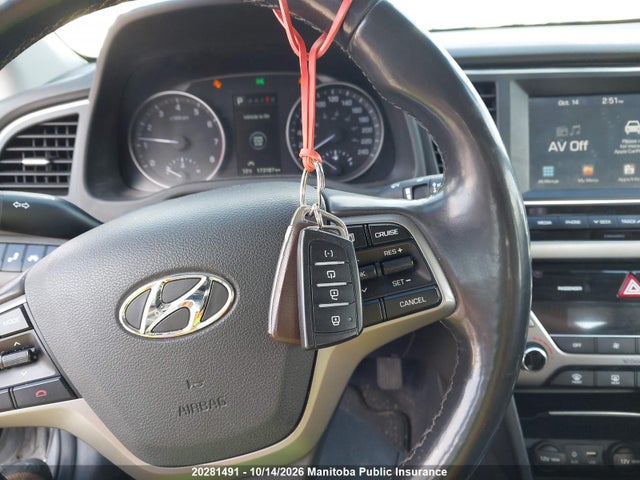 KMHD84LF9HU293558 Hyundai ELANTRA SE