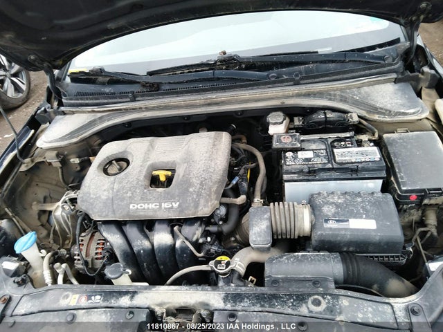 KMHD84LF6JU519366 Hyundai ELANTRA GL