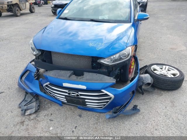 KMHD84LF9JU601740 Hyundai mpi nu