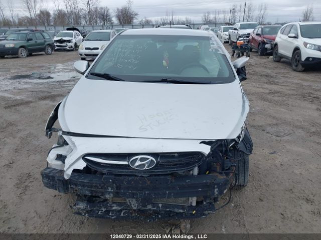 KMHCT5AEXHU341577 Hyundai ACCENT GL