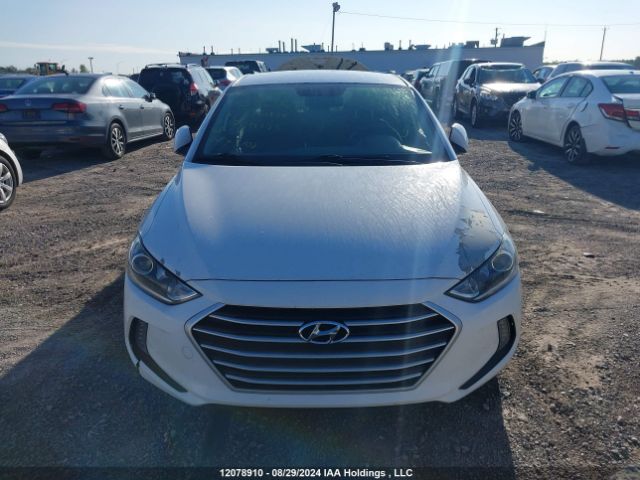 KMHD84LF2JU720133 Hyundai ELANTRA GL