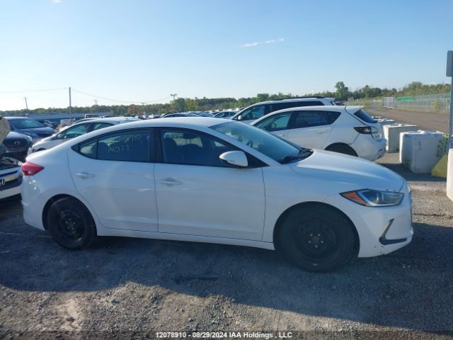 KMHD84LF2JU720133 Hyundai ELANTRA GL