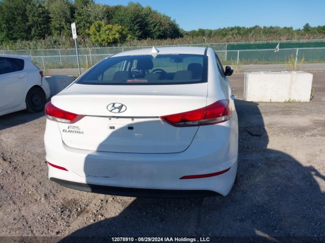 KMHD84LF2JU720133 Hyundai ELANTRA GL