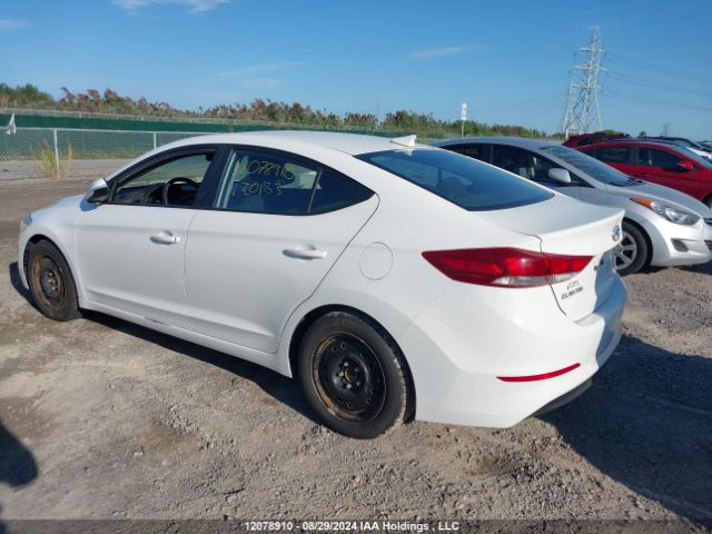 KMHD84LF2JU720133 Hyundai ELANTRA GL