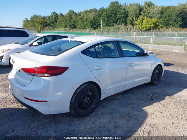 KMHD84LF2JU720133 Hyundai ELANTRA GL