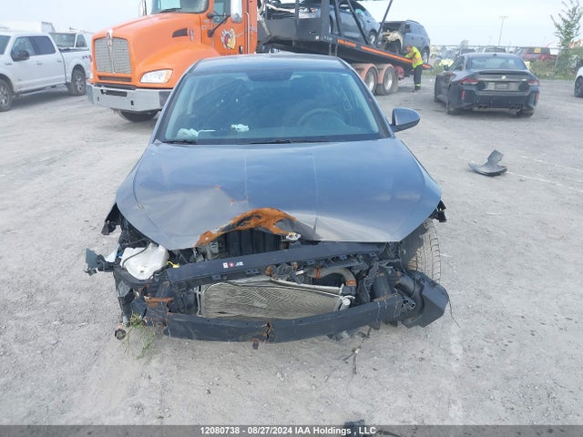KMHD74LF5LU910725 Hyundai mpi nu
