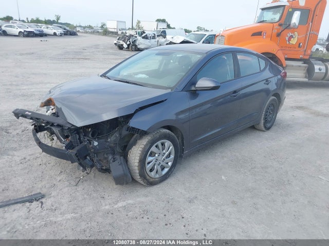 KMHD74LF5LU910725 Hyundai mpi nu