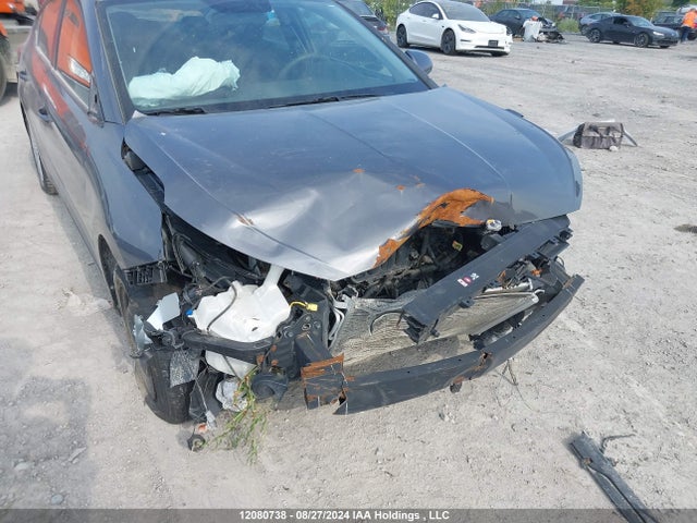 KMHD74LF5LU910725 Hyundai mpi nu