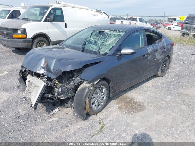 KMHD74LF1LU984398 Hyundai mpi nu
