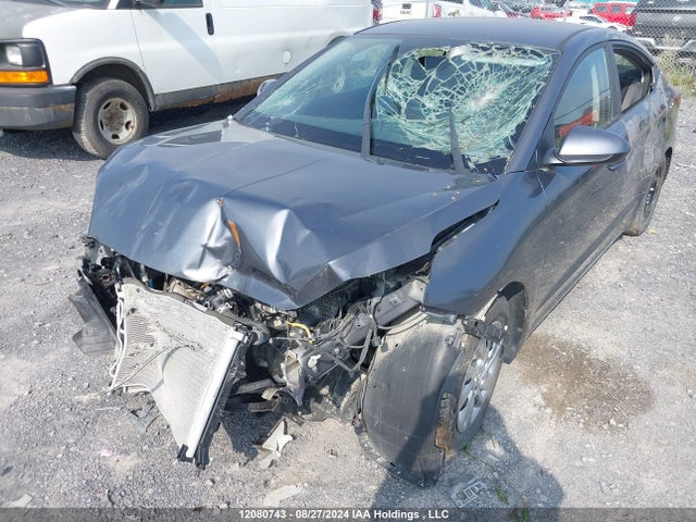 KMHD74LF1LU984398 Hyundai mpi nu