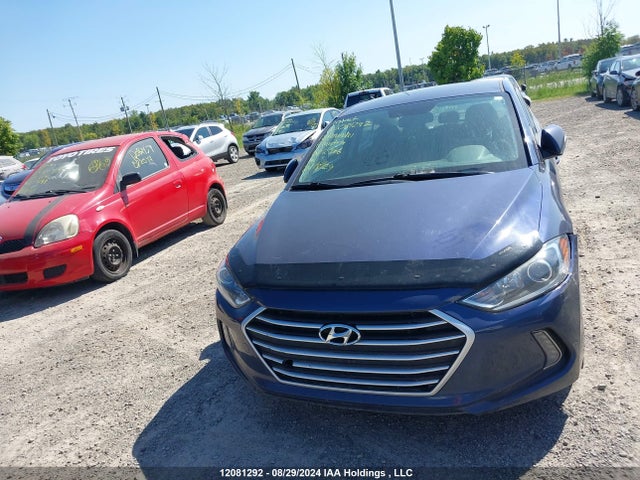 KMHD84LF0JU682966 Hyundai mpi nu