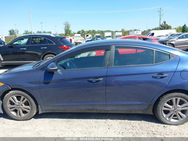 KMHD84LF0JU682966 Hyundai mpi nu