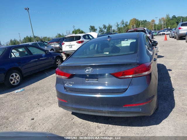 KMHD84LF0JU682966 Hyundai mpi nu