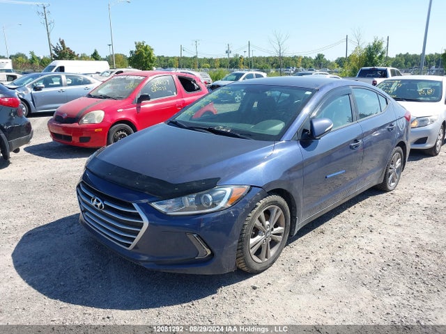 KMHD84LF0JU682966 Hyundai mpi nu