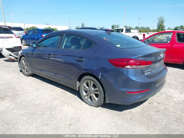 KMHD84LF0JU682966 Hyundai mpi nu