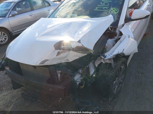 KMHD84LF9JU695053 Hyundai mpi nu