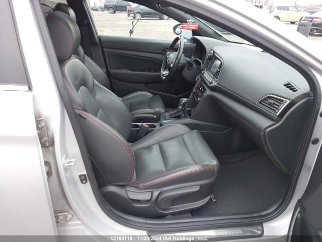 KMHD04LB0JU578224 Hyundai Elantra