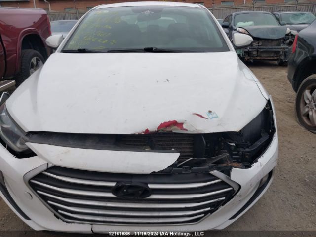 KMHD84LF1JU615681 Hyundai Elantra Sel/value/limited