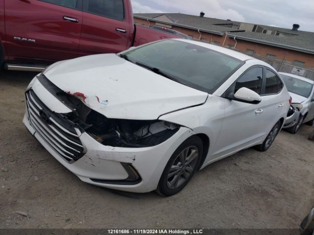 KMHD84LF1JU615681 Hyundai Elantra Sel/value/limited
