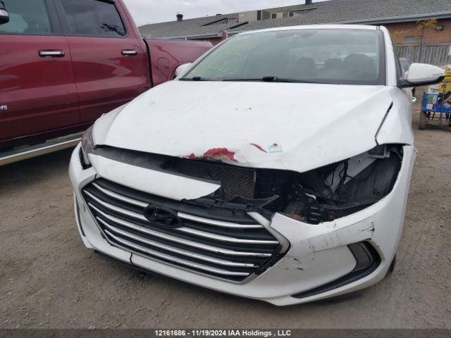 KMHD84LF1JU615681 Hyundai Elantra Sel/value/limited
