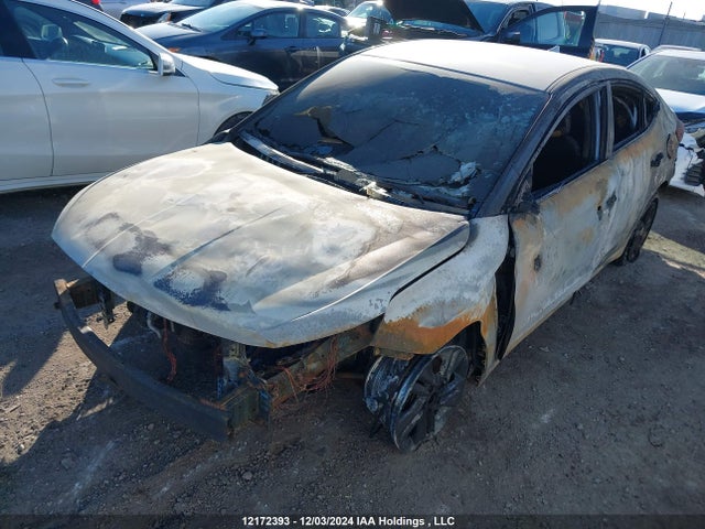 KMHD84LF7LU057712 Hyundai mpi nu