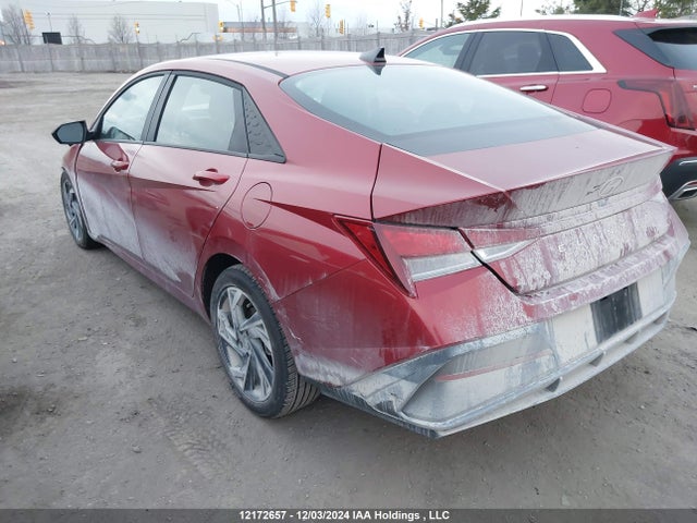 KMHLM4DG5SU869118 Hyundai mpi nu pe