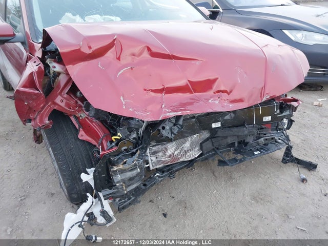 KMHLM4DG5SU869118 Hyundai mpi nu pe