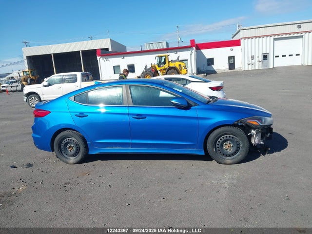 KMHD04LB5JU669943 Hyundai g 1.6 dohc t-gdi