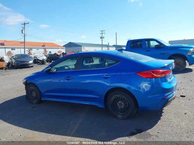 KMHD04LB5JU669943 Hyundai g 1.6 dohc t-gdi
