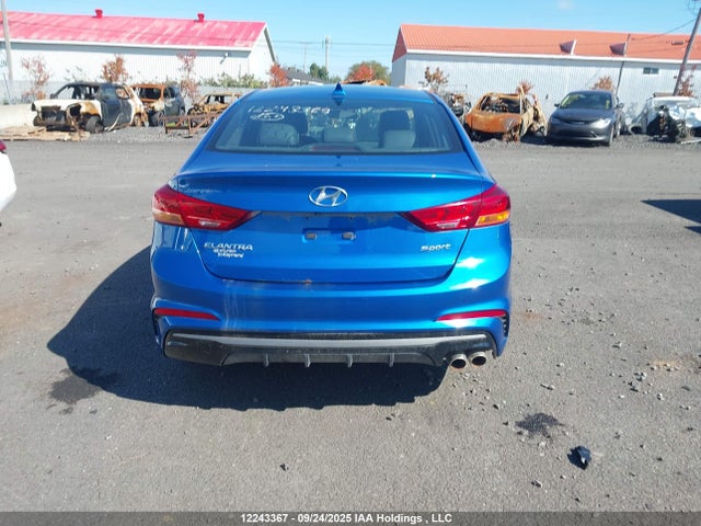 KMHD04LB5JU669943 Hyundai g 1.6 dohc t-gdi