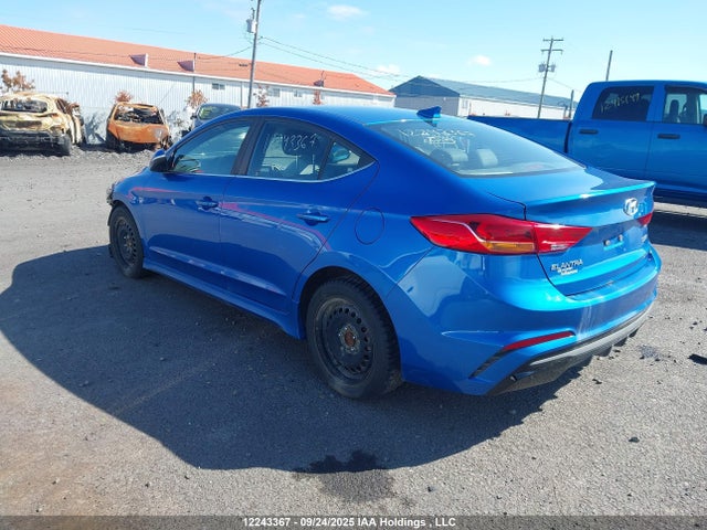 KMHD04LB5JU669943 Hyundai g 1.6 dohc t-gdi